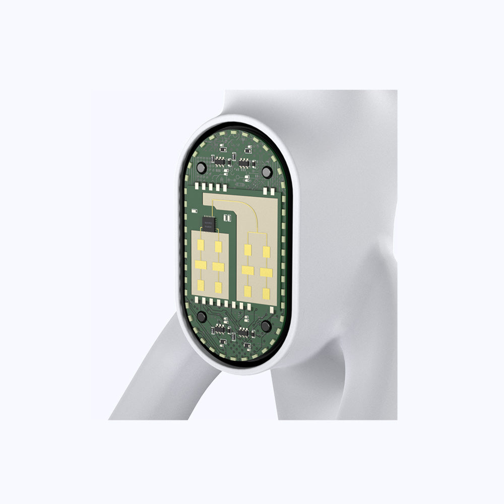 Millimeter Wave Radar